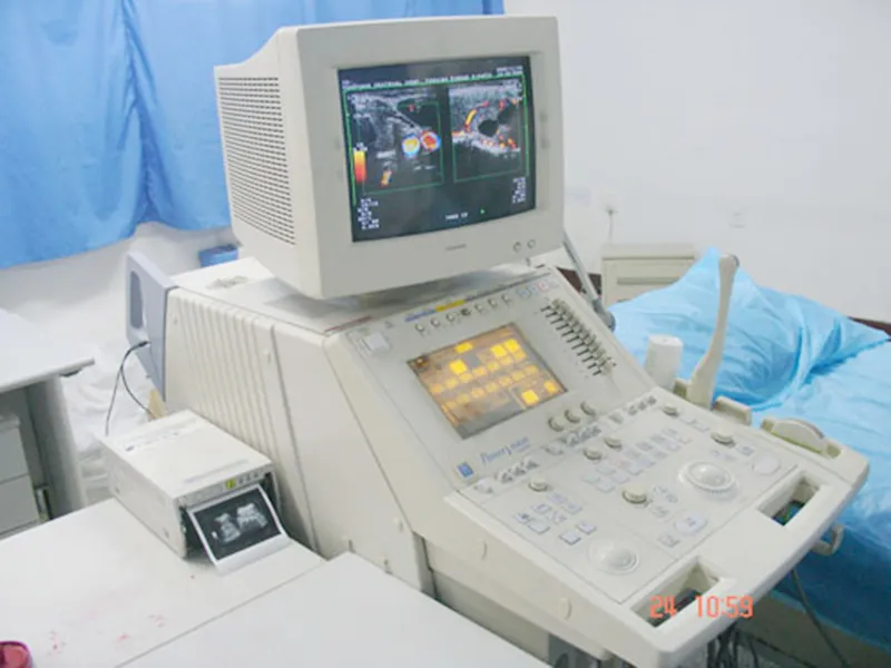 东芝6000彩色多普勒超声